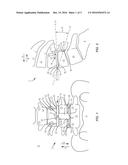 SURGICAL INSTRUMENT AND METHOD diagram and image