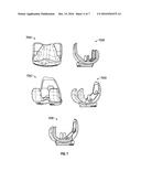 System and Methods for Positioning Bone Cut Guide diagram and image