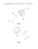 ORAL DEBRIS EXTRACTOR diagram and image