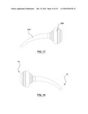 ORAL DEBRIS EXTRACTOR diagram and image