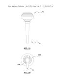 ORAL DEBRIS EXTRACTOR diagram and image