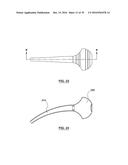 ORAL DEBRIS EXTRACTOR diagram and image