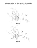 ORAL DEBRIS EXTRACTOR diagram and image