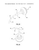 ORAL DEBRIS EXTRACTOR diagram and image