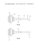 ORAL DEBRIS EXTRACTOR diagram and image