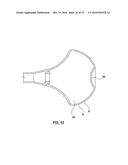 ORAL DEBRIS EXTRACTOR diagram and image