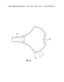 ORAL DEBRIS EXTRACTOR diagram and image