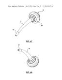 ORAL DEBRIS EXTRACTOR diagram and image