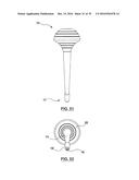 ORAL DEBRIS EXTRACTOR diagram and image