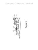 DENTAL APPLIANCE BINDING STRUCTURE diagram and image