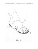 Shielding device for foot pain and discomfort diagram and image