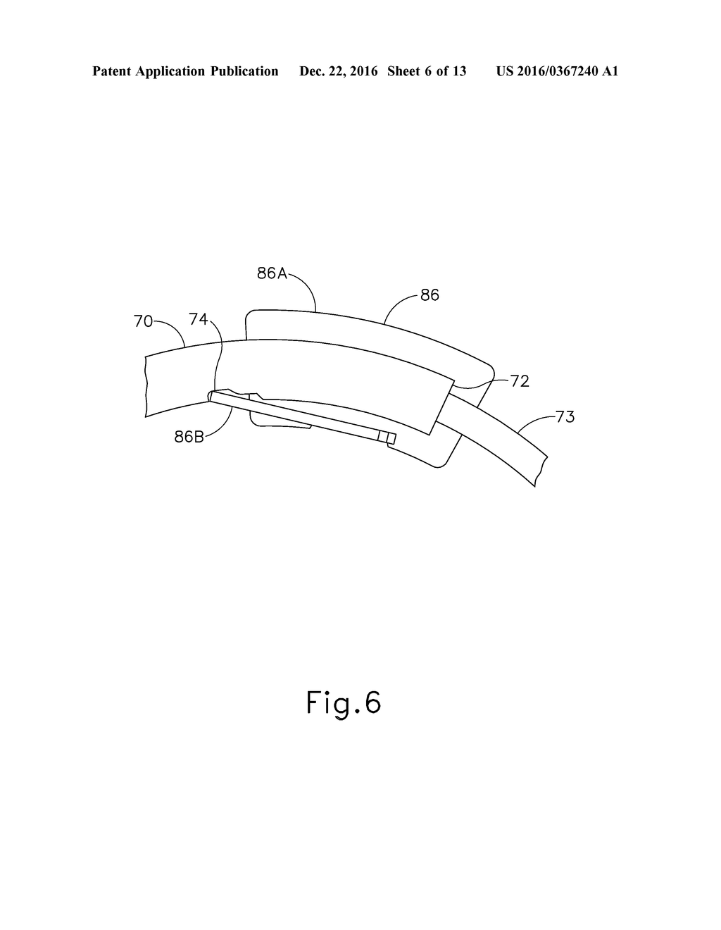 BARBED SUTURE DISPENSER - diagram, schematic, and image 07