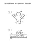 DEVICES FOR THERAPEUTIC VASCULAR PROCEDURES diagram and image