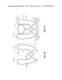 DEVICES FOR THERAPEUTIC VASCULAR PROCEDURES diagram and image