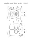 DEVICES FOR THERAPEUTIC VASCULAR PROCEDURES diagram and image