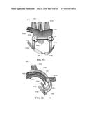 ADAPTIVE SURFACE SURGICAL GUIDING APPARATUSES INCLUDING STABILITY AND/OR     VERIFICATION ELEMENTS diagram and image