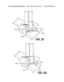 Bone Fusion/Fixation Device and Related Systems and Methods diagram and image
