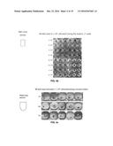 PREPARATION METHOD FOR THERAPEUTIC AGENT OF BEAD-TYPE CHONDROCYTE diagram and image