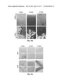PREPARATION METHOD FOR THERAPEUTIC AGENT OF BEAD-TYPE CHONDROCYTE diagram and image