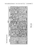 THROMBOXANE RECEPTOR ANTAGONISTS diagram and image