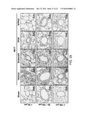 THROMBOXANE RECEPTOR ANTAGONISTS diagram and image