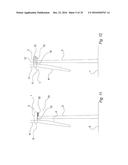 FIXATION DEVICE FOR SERVICING WIND TURBINE COMPONENTS diagram and image