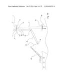 FIXATION DEVICE FOR SERVICING WIND TURBINE COMPONENTS diagram and image