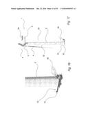 FIXATION DEVICE FOR SERVICING WIND TURBINE COMPONENTS diagram and image