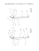 FIXATION DEVICE FOR SERVICING WIND TURBINE COMPONENTS diagram and image