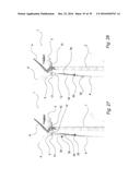 FIXATION DEVICE FOR SERVICING WIND TURBINE COMPONENTS diagram and image