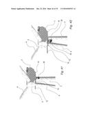 FIXATION DEVICE FOR SERVICING WIND TURBINE COMPONENTS diagram and image