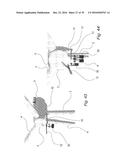 FIXATION DEVICE FOR SERVICING WIND TURBINE COMPONENTS diagram and image