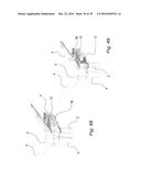 FIXATION DEVICE FOR SERVICING WIND TURBINE COMPONENTS diagram and image