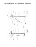 FIXATION DEVICE FOR SERVICING WIND TURBINE COMPONENTS diagram and image