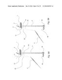 FIXATION DEVICE FOR SERVICING WIND TURBINE COMPONENTS diagram and image