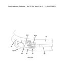 COMMUNICATION TOWER PANEL SECURITY DEVICE EMPLOYING FLEXIBLE PLASTIC     BANDING AND A CONNECTING/TENSIONING ASSEMBLY HAVING PASS-THROUGH CHANNELS     FOR SAFELY SECURING RADIATION-TRANSPARENT PANELS COVERING ANTENNA SERVICE     BAYS OF A WIRELESS TELECOMMUNICATION TOWER diagram and image