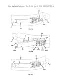 COMMUNICATION TOWER PANEL SECURITY DEVICE EMPLOYING FLEXIBLE PLASTIC     BANDING AND A CONNECTING/TENSIONING ASSEMBLY HAVING PASS-THROUGH CHANNELS     FOR SAFELY SECURING RADIATION-TRANSPARENT PANELS COVERING ANTENNA SERVICE     BAYS OF A WIRELESS TELECOMMUNICATION TOWER diagram and image