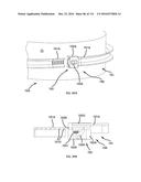 COMMUNICATION TOWER PANEL SECURITY DEVICE EMPLOYING FLEXIBLE PLASTIC     BANDING AND A CONNECTING/TENSIONING ASSEMBLY HAVING PASS-THROUGH CHANNELS     FOR SAFELY SECURING RADIATION-TRANSPARENT PANELS COVERING ANTENNA SERVICE     BAYS OF A WIRELESS TELECOMMUNICATION TOWER diagram and image