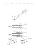 Atraumatic Arthroscopic Instrument Sheath diagram and image