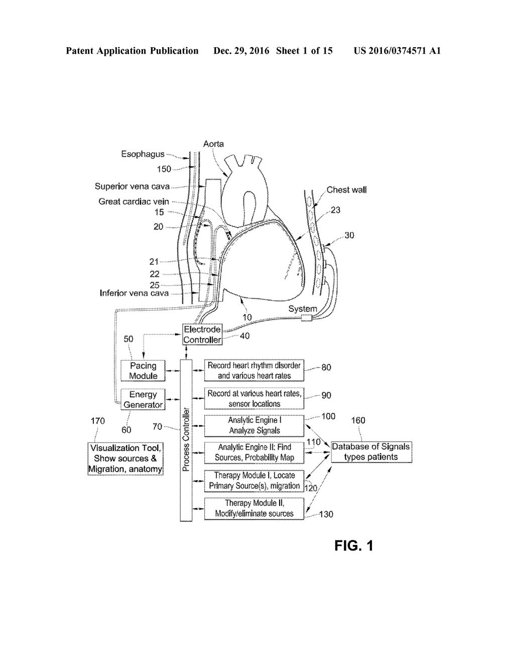 METHOD FOR ANALYSIS OF COMPLEX RHYTHM DISORDERS - diagram, schematic, and image 02