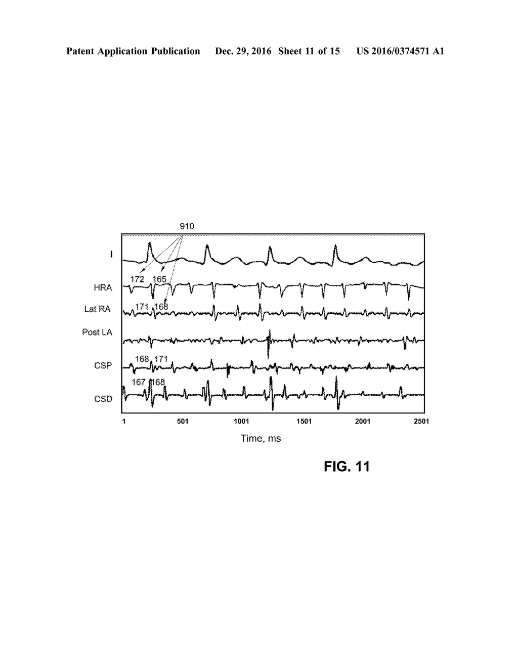 METHOD FOR ANALYSIS OF COMPLEX RHYTHM DISORDERS - diagram, schematic, and image 12