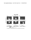 DETERMINING PHYSIOLOGICAL PARAMETERS USING MOVEMENT DETECTION diagram and image