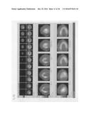 Rapid image analysis - fleming harrington redistribution wash-in washout     method for differentiation of inflammatory vascular disease (IVD) and     tissue viability diagram and image