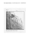 Rapid image analysis - fleming harrington redistribution wash-in washout     method for differentiation of inflammatory vascular disease (IVD) and     tissue viability diagram and image