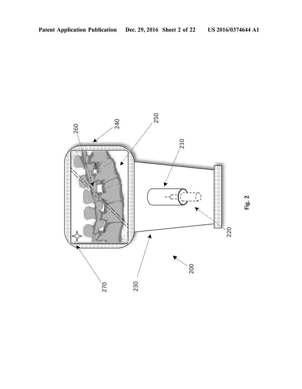 Ultrasonic Guidance of a Probe with Respect to Anatomical Features - diagram, schematic, and image 03