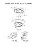 WEARABLE DEVICE AND METHOD FOR COLLECTING OCULAR FLUID diagram and image