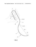 Tongue anteriorizer and method of operating same diagram and image