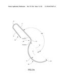 Tongue anteriorizer and method of operating same diagram and image