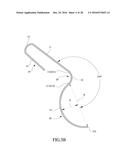 Tongue anteriorizer and method of operating same diagram and image