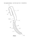 Tongue anteriorizer and method of operating same diagram and image